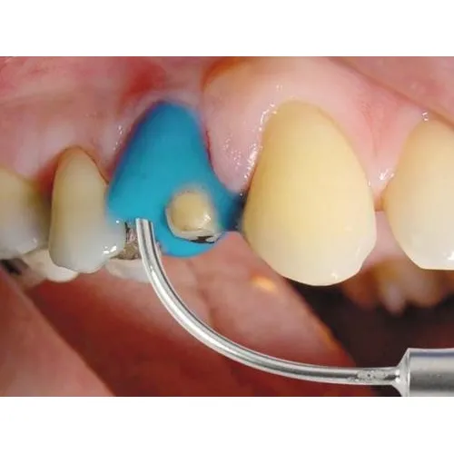 HAGER&WERKEN ALGILOID CILINDER AMPULLEN (48st)