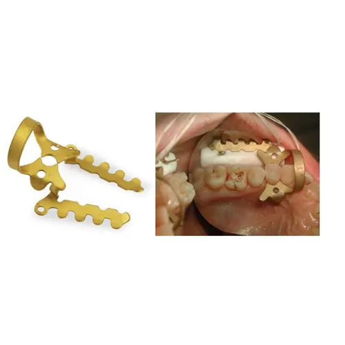 KKD NEW HALLER COFFERDAMKLEM 2AO - GOLD