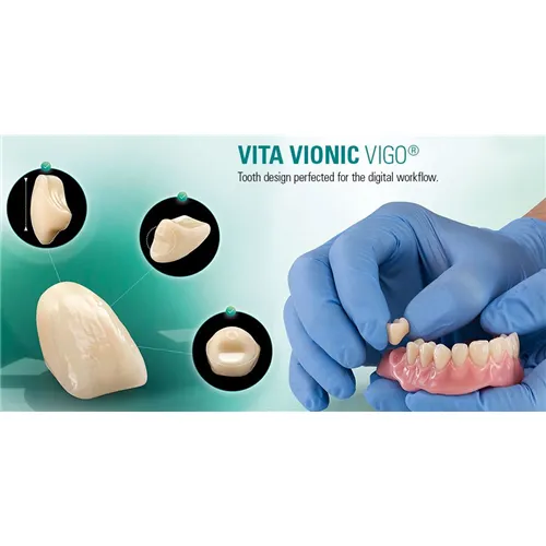 VITA VIONIC VIGO POSTERIOR 23L-A1 BOVENKAAK (8st)