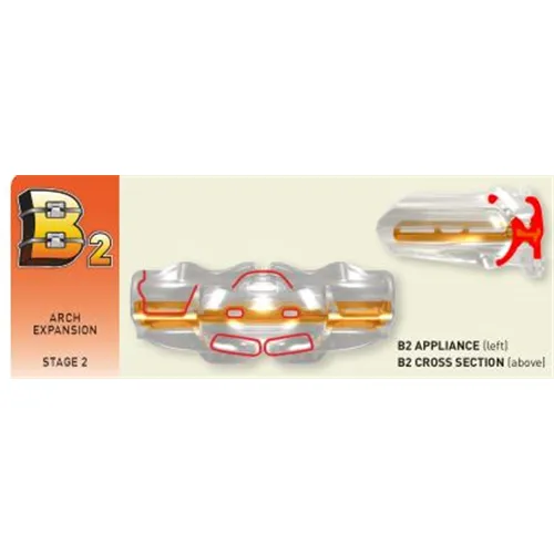 MYOFUNCTIONAL MYOBRACE FOR BRACES B2 MEDIUM CLEAR 415030