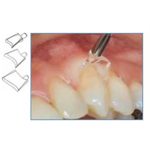 LM GINGIVAL RETRACTOR SCHILDJES SMALL NR.7502