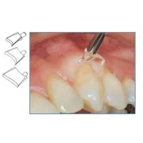 LM GINGIVAL RETRACTOR SCHILDJES EXTRA-LARGE NR.7506
