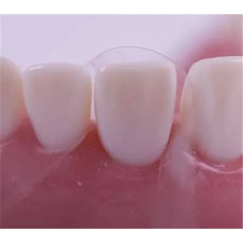DIRECTA PROXYPAL 3D ANTERIOR MATRIX (36st)