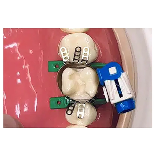 RHONDIUM QUICKCONNECT STARTER KIT KOMPLEET - 1