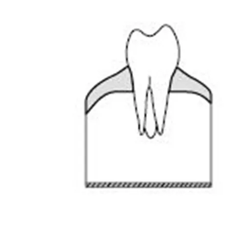 KAVO SIMULATIEMODEL ELEMENT 4-7 MOLAREN (100st) REF 0.623.1475
