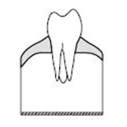KAVO SIMULATIEMODEL ELEMENT 4-5 MOLAREN (100st) REF 0.623.1455