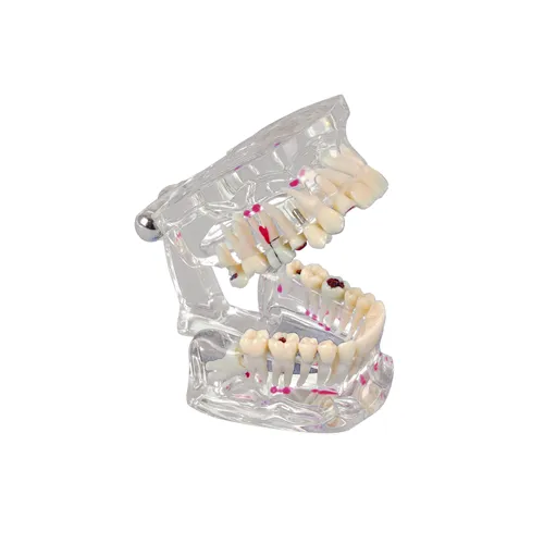LACTONA TRANSPARANT GEBITSMODEL