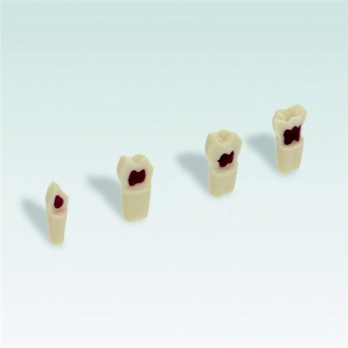 FRASACO MODEL TAND GEVULD MET WAX VOOR PULPATOMIE OEFENINGEN